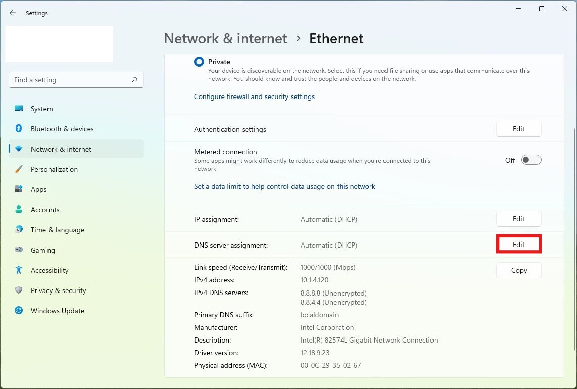 DNS settings Edit: Fix Slow Ethernet Speed